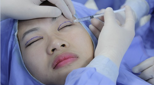 Bấm mí mắt có ảnh hưởng gì không Bấm mí mắt có ảnh hưởng gì không