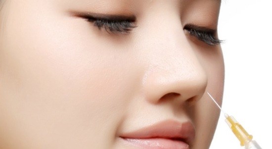Sửa mũi không cần phẫu thuật