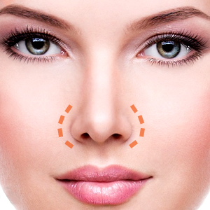 Sửa mũi không được ăn gì Sửa mũi không được ăn gì