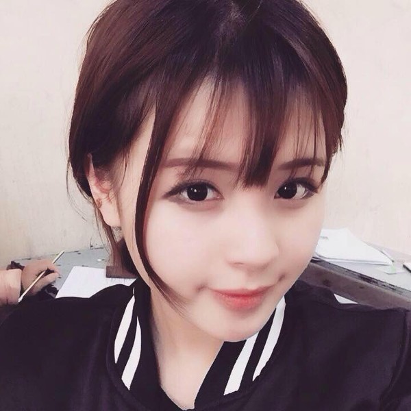 Cắt mí sưng bao lâu