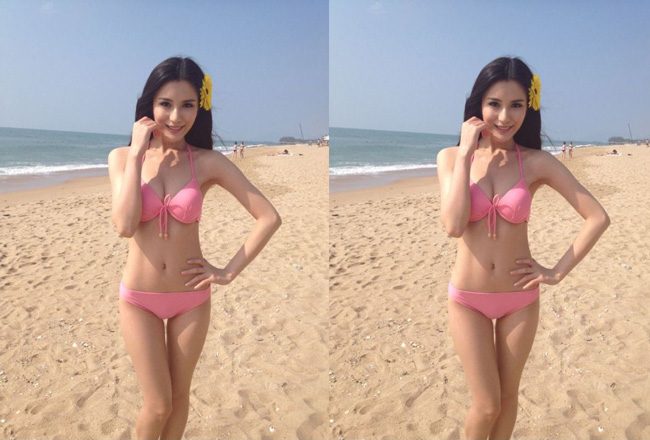 Diễn đàn hút mỡ bụng