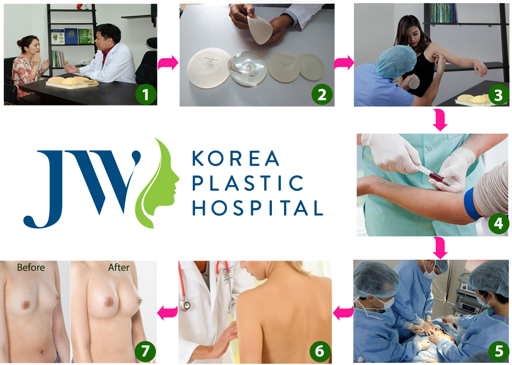 Phương pháp nâng ngực an toàn nhất 2018 - Ảnh 8
