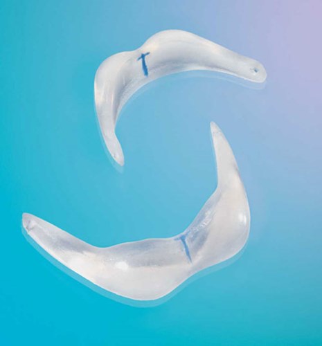 Độn cằm bằng Implant Độn cằm bằng Implant