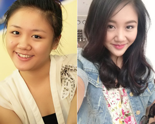 Độn cằm sao Việt