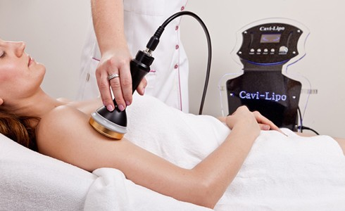 Hút mỡ Cavi Lipo Hút mỡ Cavi Lipo