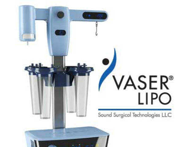 Hút mỡ Vaser Lipo Hút mỡ Vaser Lipo