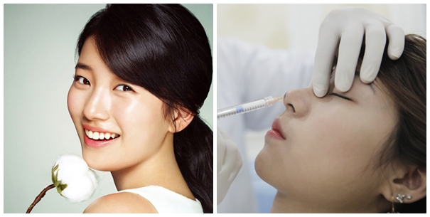 Sửa mũi không cần phẫu thuật giá bao nhiêu Sửa mũi không cần phẫu thuật giá bao nhiêu