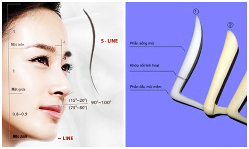 Giải đáp những lo lắng hàng đầu của chị em khi phẫu thuật nâng mũi