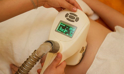 Hút mỡ không phẫu thuật Cavi-Deluxe Hút mỡ không phẫu thuật Cavi-Deluxe