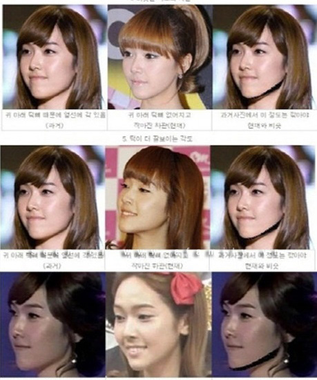 Jessica gọt mặt Jessica gọt mặt