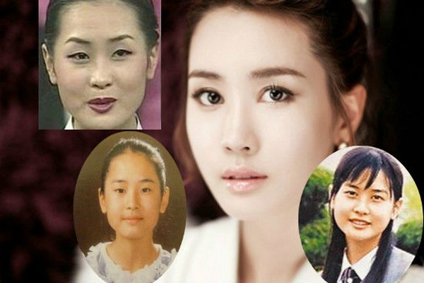Sao cắt mí mắt Sao cắt mí mắt