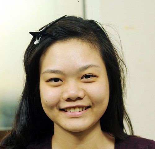 Sửa mũi Hàn Quốc JW