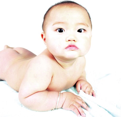 Phẫu thuật thẩm mỹ mắt lé