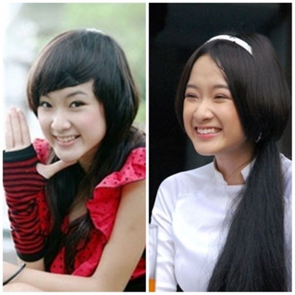 Phương Trinh phẫu thuật ngực Phương Trinh phẫu thuật ngực