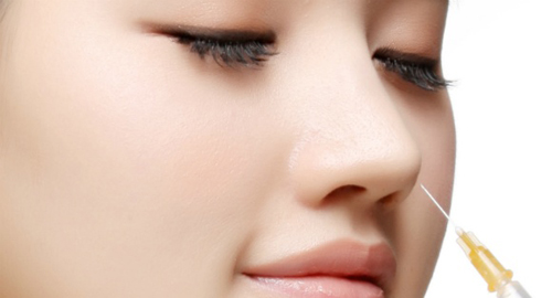 Nâng mũi không phẫu thuật ở đâu tốt Nâng mũi không phẫu thuật ở đâu tốt