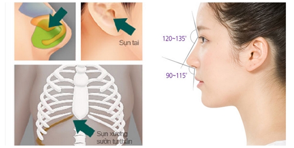 Địa chỉ phẫu thuật nâng mũi uy tín Địa chỉ phẫu thuật nâng mũi uy tín
