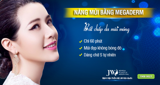 nâng mũi s line sụn megaderm