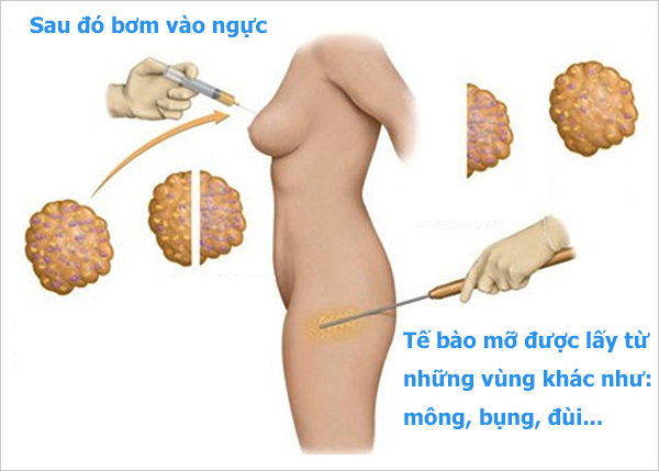 nang-nguc-mo-tu-than
