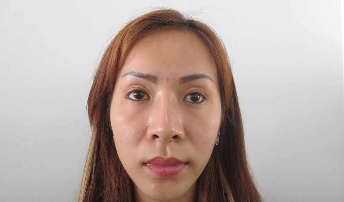 toi-bong-tre-ra-5-tuoi-nho-cay-mo-mat-1