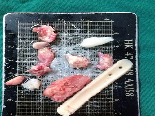 câu chuyện khách hàng
