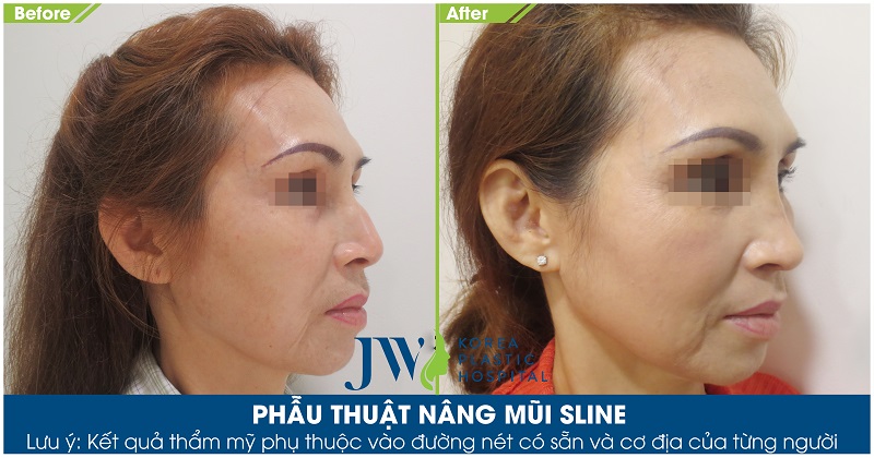 nang-mui-s-line1