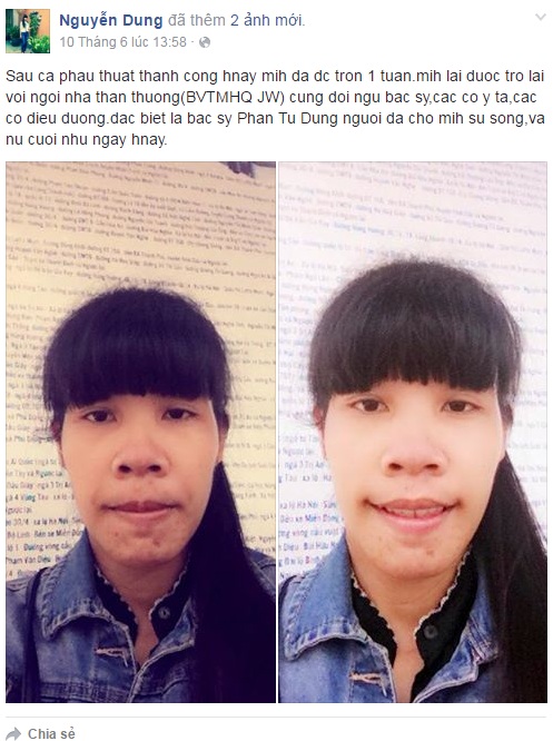Dung 4