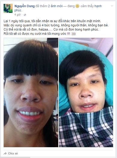 Món quà đặc biệt dành cho cô gái từ bỏ ước mơ chữa hô hàm để cứu em trai Món quà đặc biệt dành cho cô gái từ bỏ ước mơ chữa hô hàm để cứu em trai