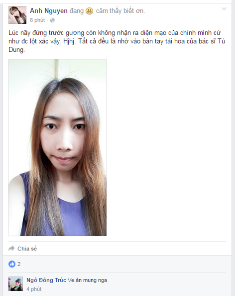 hong-anh-face