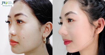 nang mui s line