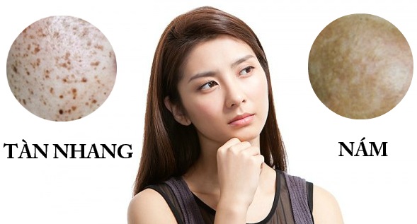 cham-soc-da-nam-va-tan-nhang