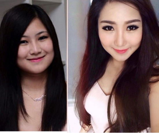 nhung-sao-viet-phau-thuat-tham