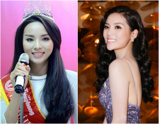 sao-viet-bi-don-phau-thuat-tham