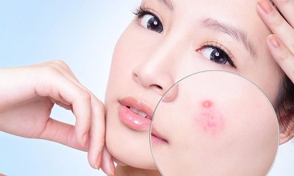 Lăn kim tế bào gốc ở đâu an toàn