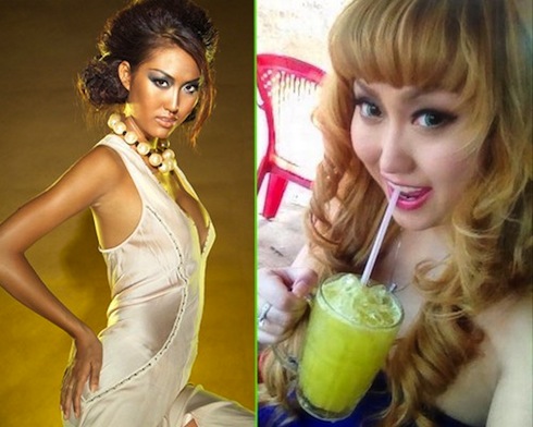 Thảm họa thẩm mỹ của sao Việt