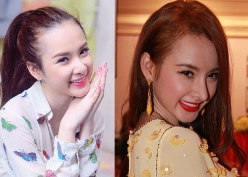 nhung-sao-viet-phau-thuat-tham