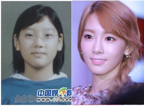 snsd-co-phau-thuat-tham-hay-khong