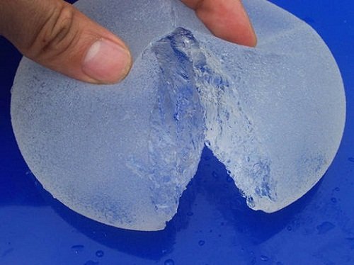 Vì sao nên đặt túi ngực Nano Chip