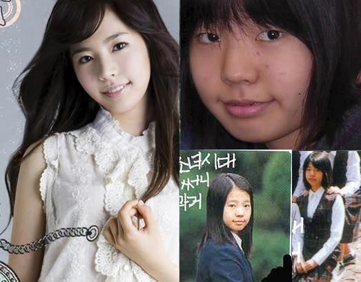 Scandal phẫu thuật thẩm mỹ của SNSD