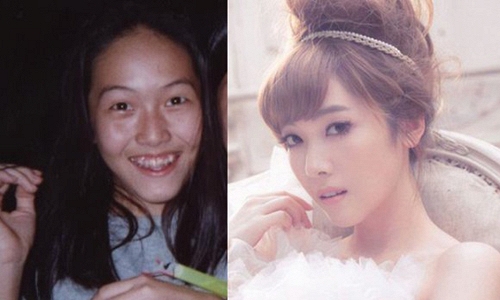 Scandal phẫu thuật thẩm mỹ của SNSD