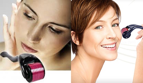 Lăn kim tế bào gốc trị nám