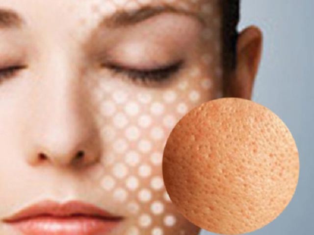 Chi phí lăn kim tế bào gốc