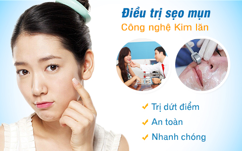 Lăn kim tế bào gốc có tác dụng gì