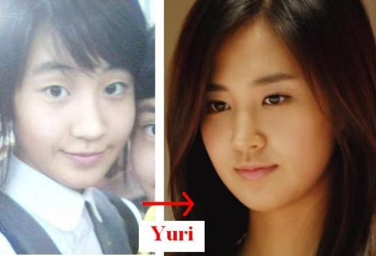 Scandal phẫu thuật thẩm mỹ của SNSD
