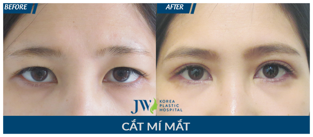 cat-mi-mat-8