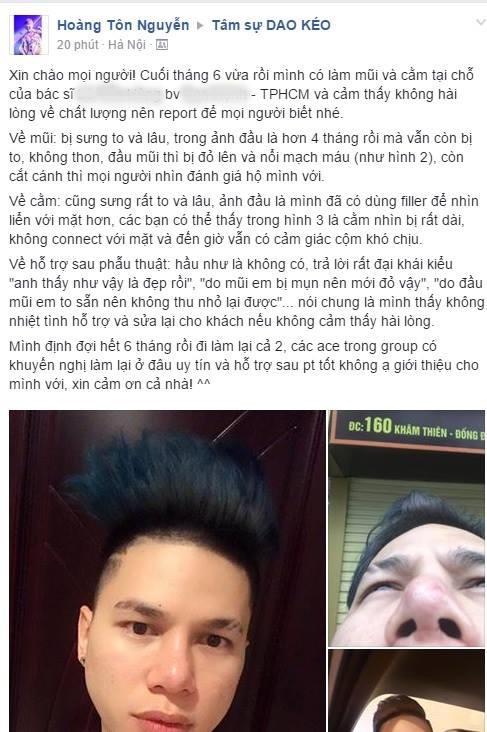Bệnh viện nào có chuyên khoa tái phẫu thuật mũi