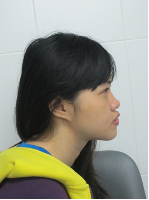 Có lần Hồng Anh trải lòng với mẹ và hỏi “tại sao?” nhưng không tìm kiếm được câu trả lời, mẹ cô hứa sẽ đưa cô đi chữa trị khuyết điểm này Có lần Hồng Anh trải lòng với mẹ và hỏi “tại sao?” nhưng không tìm kiếm được câu trả lời, mẹ cô hứa sẽ đưa cô đi chữa trị khuyết điểm này