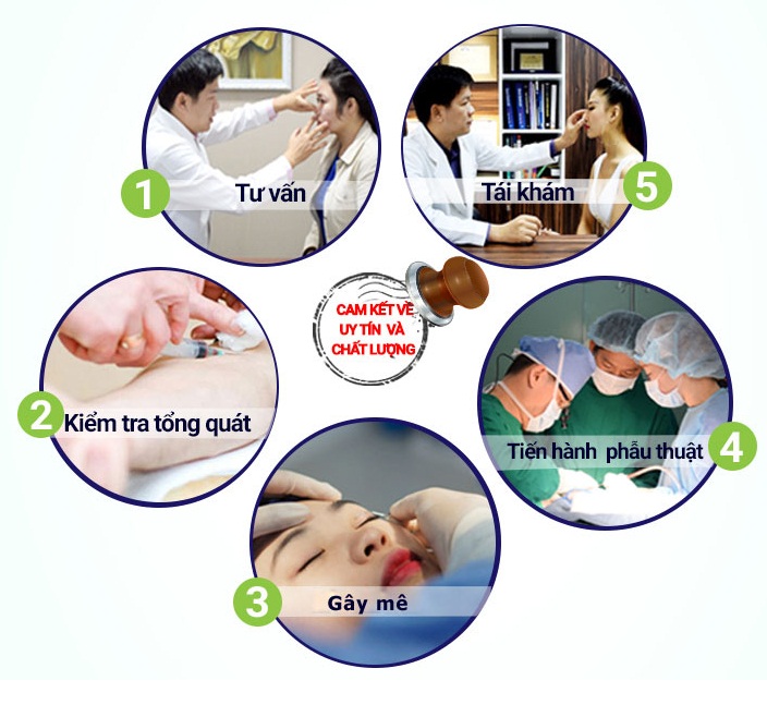 Phẫu thuật nâng mũi Hàn Quốc những điều quan trọng đừng bỏ lỡ - Ảnh 3