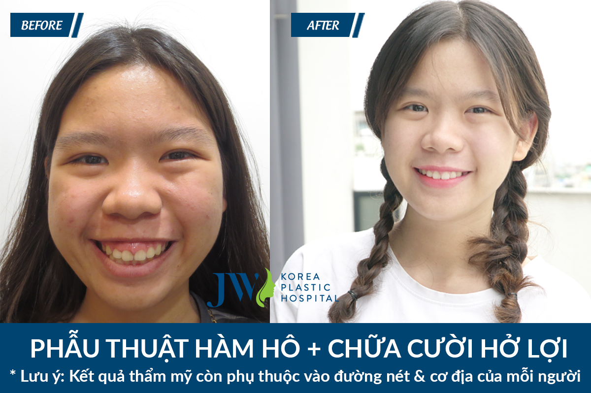nen-phau-thuat-tham-my-o-dau-6