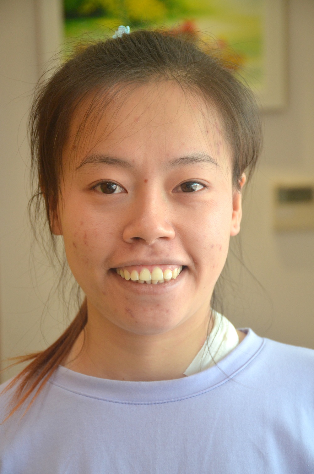 co-gai-tre-rang-ngoi-sau-cuoc-tan-trang-ham-ho