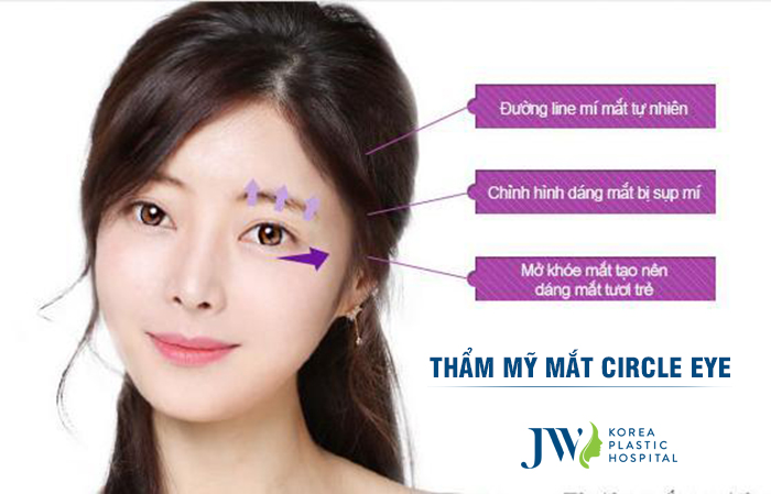 thẩm mỹ mắt to